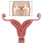 Cérvix ou colo do útero