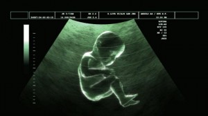 ecografia de diagnóstico gravidez 