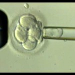 Fertilizacao in vitro
