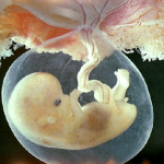 Desenvolvimento da placenta